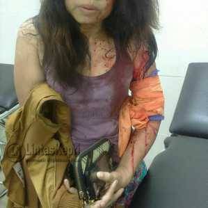 Korban Yetty Srihajar Riawati, saat mendapatkan pertolongan dari Polsek Bukit Bestari.